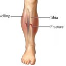 뻔치복싱클럽 이미지