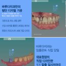 덴탈디자인치과기공소 이미지