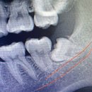 유성온치과의원 이미지