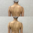 수원 다이어트 치장 부작용없는 에어바디 1회관리후기