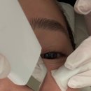 경원대로 1395(부평일번가) 앞 | 인천 부평피부관리 에스테틱 블랙헤드 수분초음파 후기 부평 데자뷰메디스킨 인천점