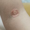 상록수보건소 | 안산 상록수보건소 혈당, 당화혈색소 검사, B형간염 항체검사 가격, 후기