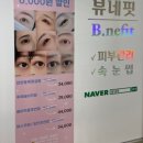 뷰네핏
