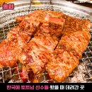 종아리 쥐 통증 원인 이미지