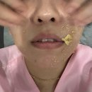 로덱스앤리버스 | 양주 피부관리 로덱스스킨앤왁싱에서 V.I.P 골드테라피 후기