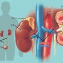 신장이 안좋으면 나타나는 증상 이미지