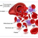 골수조혈기능을 파괴하는 항암 방사선 보고 이미지