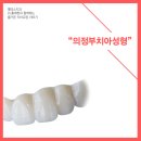 네츄럴치과기공소 | 의정부치아성형 잘하는곳은 어디?
