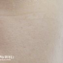 유니끌린