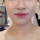 본식전 피부관리 - 평촌 라마르에서 3주만에 여드름 탈출한 후기 (쥬베룩 더마샤인, plzet레이저, 엑셀V...
