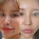 [코젤코 후기] 내 돈 내산(5개월 차)