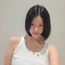 귀족 - 김해시 번화1로76번길 16 | 귀족수술 2개월 후기 | 웃을 때 얼굴 변화
