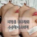수수 | 광주 계림동 스킨플래닝 잘하는 곳 수수한에스테틱 후기