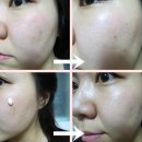 [수려한 백삼 미백 앰플 에센스] 나이색을지워 하얗게!! 나이결을 지워 매끈하게!! 효과를 톡톡히 보고...