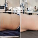권스킨앤바디샵 네이버블로그