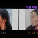 서면정형외과의원 | [부산 피부과 추천] 더붐의원 부산서면 부산 피부과 추천 더붐의원