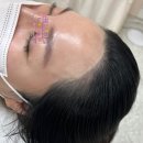 미작뷰티 인천점 헤어라인문신 리터치 1회차 후기