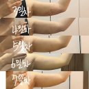 심슨(주) | 지팻주사 팔뚝 1주차 후기｜멍,붓기 변화 과정 총정리 (다이어트X, 친구와 비교)