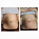 구로-현장-구로-1201 | 대림산후마사지 퀸즈모아 강서점 후기 – 집에서 받는 진짜 회복 케어