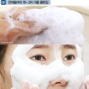 성한아이엔티 - 고양시 덕양구 화중로 128 | 턱 화이트헤드 케어 생각보다 너무 간단한데요?