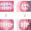 미소안치과의원 이미지