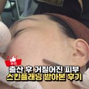 샵 미쁨 | 검단피부관리 출산 후 거칠어진 피부, 미쁨뷰티 스킨플래닝 후기