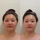 디유에스테틱 - 성남시 수정구 위례광장로 300 | 청담피부관리 추천! 디유에스테틱 프리베 청담점 이중턱제로프팅 후기