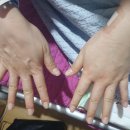 한아름약국 | 분당제일여성병원 자궁근종 복강경 수술 후기 ⑤ 수술다음날&amp;퇴원하기 -[최인철원장님]-
