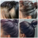 태환농장 | 올정한자라모/원형탈모 두번째이야기 ( 올정한자라모샴푸 3종세트 샴푸후기)