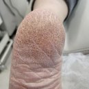 푸스케어 남포점 글림네일 이미지