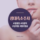 광대축소주사후기 3세대 뷰티아이템