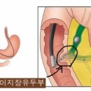 췌장암’ 발병과정 및 진단 이미지