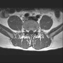 mri 상태를 진단받고싶습니다 이미지