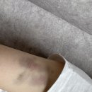 피어랑의원 이미지