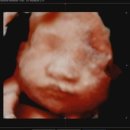 일산제일산부인과의원 이미지