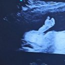 민산부인과의원 | 서브병원(서초하나산부인과)/분만병원 정하기(강남차병원 미래와희망 청담마리)