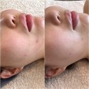유성메디칼 | 대전 유성 에스테틱 글로위스킨 윤곽관리 받고 온 리얼후기