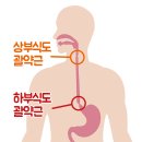 가슴쓰림 원인, 역류성식도염 치료병원은? 이미지