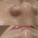 뷰티엔스킨 | 범계 스킨플래닝 후기 요철·잔털·피지 정리까지 가능한 피부관리 받고 온 후기
