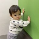 이소성 몽고반점 치료 후기(종로 에스앤유 피부과)