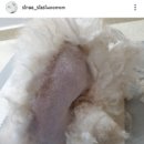 춘자네 개발바닥 이미지