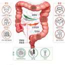 100세건강약국 - 강남구 헌릉로571길 7 | 네이쳐스탑 아이비에스 IBS, 예민한 장건강·면역력증진·피부건강을 위한 알로에 겔 3중 케어 솔루션
