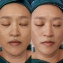 벨롱커피&공방 | [내포피부관리,내포두피관리 내포웨딩관리] 내포 온유함에서 결혼전 엄마랑 신부관리,혼주관리 후기