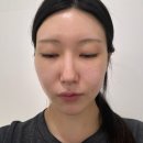 이윤에스테틱 | 달서구 에스테틱 제이우에스테틱 다양한 미용기기를 활용하는 진천동 피부관리샵
