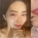 멀츠아시아퍼시픽 피티이엘티디 | [머니투데이] [단독]권민아도 화상 입었는데, 리프팅 부작용 피해구제 연 14건뿐…"제도 공백"_260622