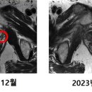 나노그람 이미지
