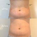 브릭스 | 창원 웨딩관리 중동 어반브릭스 매끄네에스테틱 복부관리후기