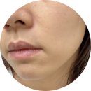 날샘 바이오 | 피지스케일링 오어블 포어 매트릭스 바이오 셀룰로오스 마스크 팩 으로 모공 관리 후기