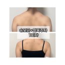 올뉴팻 주식회사 | w1.[결혼준비/뷰티] 마곡 승모근 보톡스·팔뚝 바디조각주사 1회차 후기