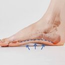 아치날 이미지